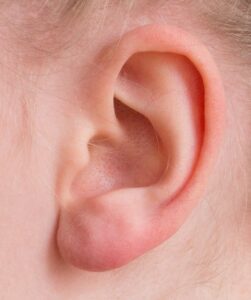 lekko czerwone ucho